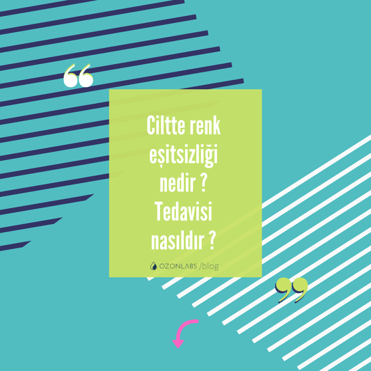 Renk Eşitsizliği Ozonlabs